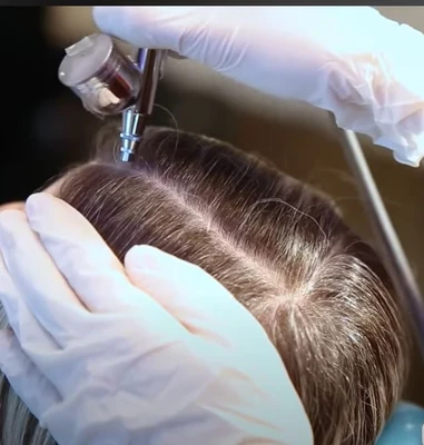 טיפולי pure oxygen